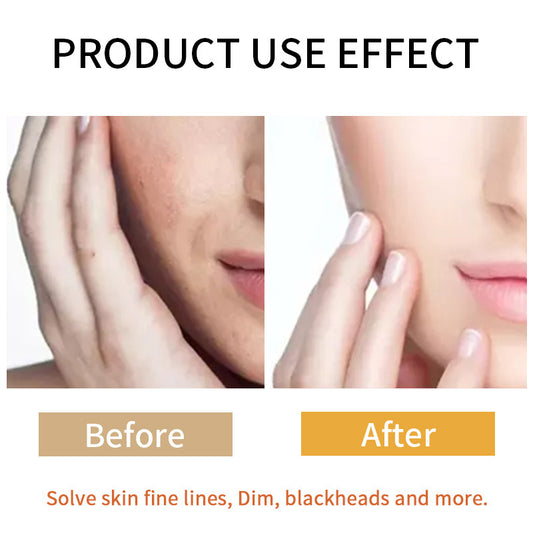 Turmeric Powder Facial Care Ginger Yellow Skin Care Set